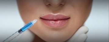 Lip Injection
