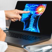 Doctor showing a x-ray of pain in the brain. Migraine Headache concept. High quality photo Doctor showing a x-ray of pain in the brain. Migraine Headache concept. High quality photo